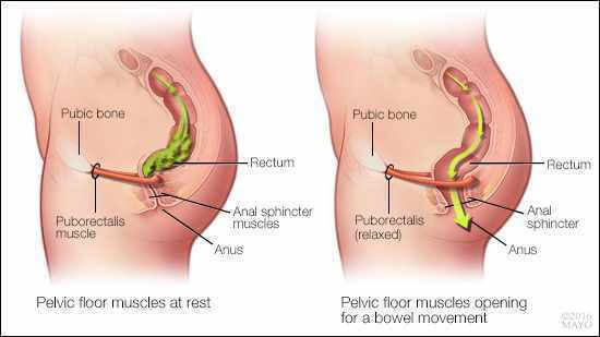 2 part image demonstrates the need for pelvic floor muscle relaxation in order to evacuate bowels