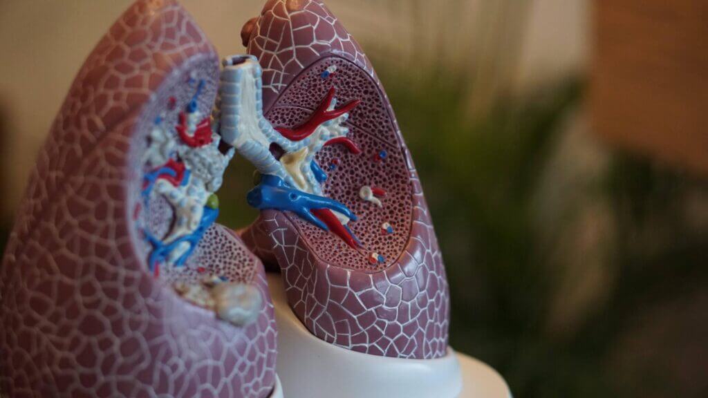 Picture of a 3D medical model of the lungs on a stand with different parts colored differently