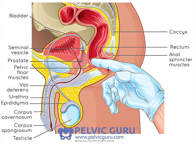 Can pelvic organ prolapse be a sign of cancer?