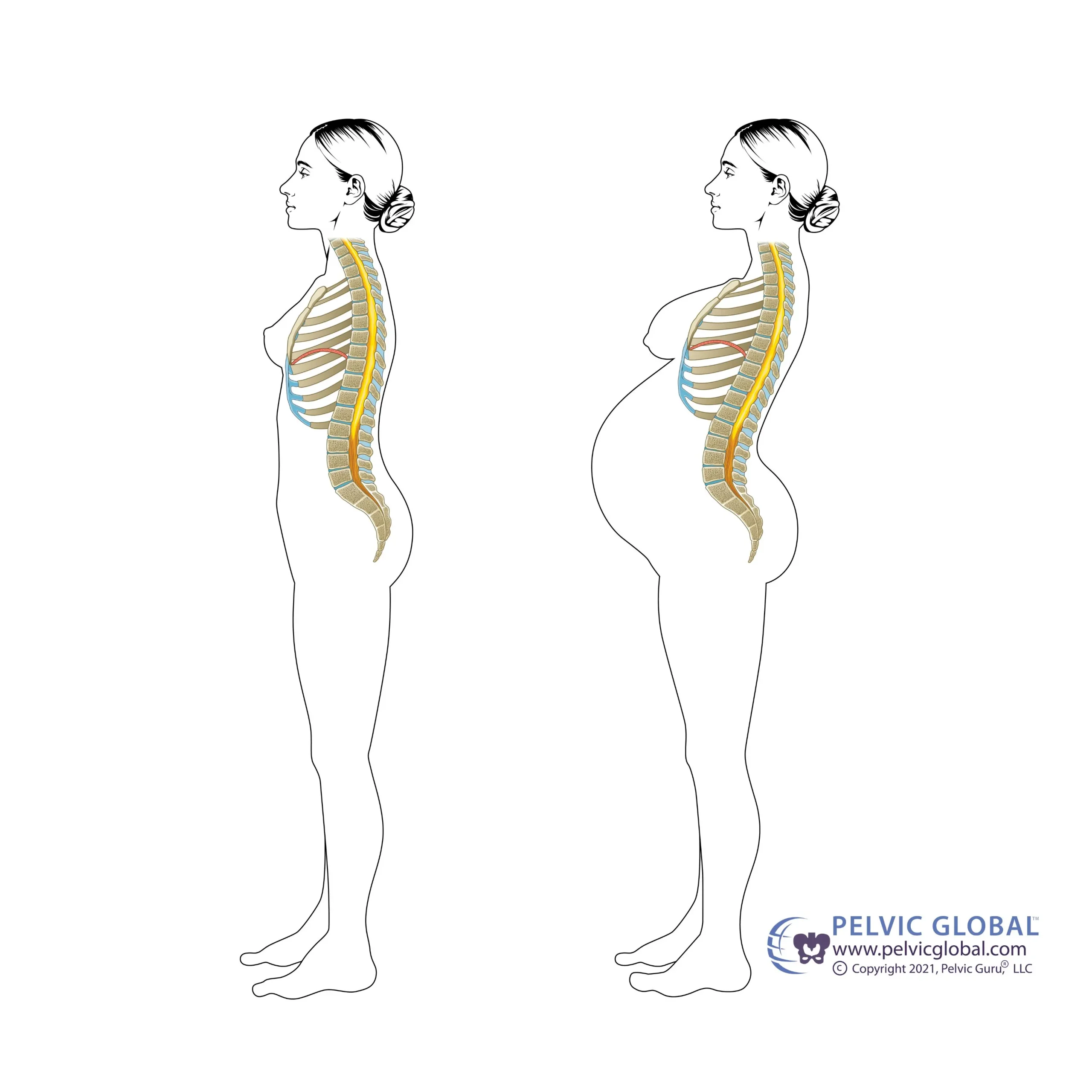 posture-with-pregnancy-pelvic-guru illustration of a non-pregnant person's posture compared to a pregnant person's posture